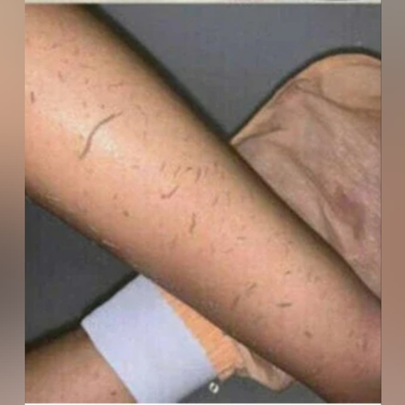 The Moroccan Kessa Exfoliating Glove: Your Path to Radiant Skin - Picture 1 of 5